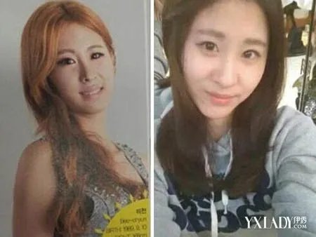 张碧晨整容前后判若两人大妈变少女的华丽转身