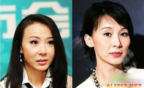 绝色美女整容过度 明星也难逃老残雷人宿命