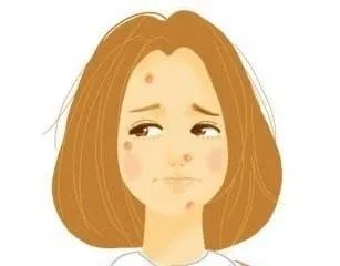 美白祛痘印的妙招