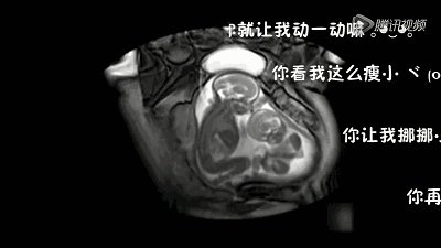 怀了双胞胎，他们会在妈妈肚子里打架吗？