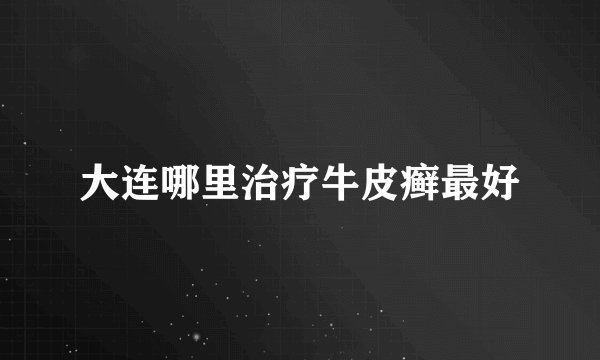 大连哪里治疗牛皮癣最好