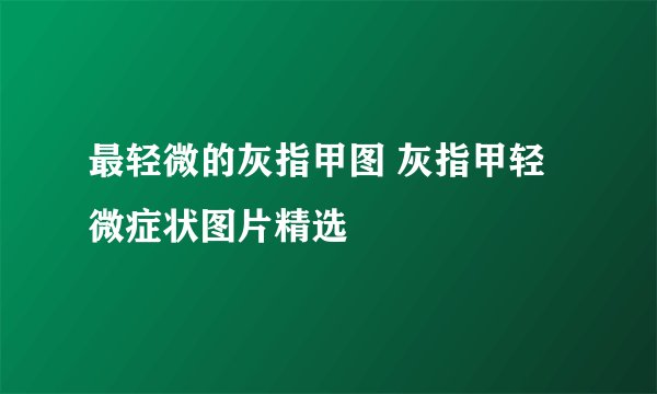 最轻微的灰指甲图 灰指甲轻微症状图片精选