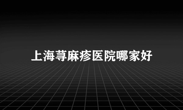 上海荨麻疹医院哪家好
