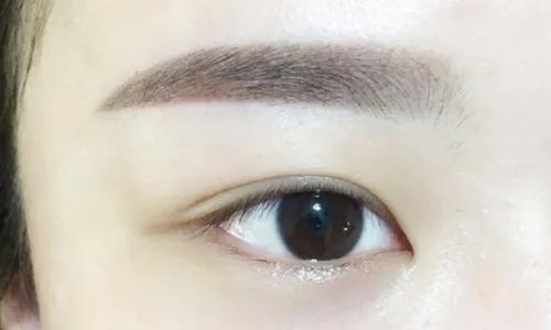 消除眼袋什么价格