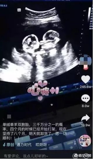 怀了双胞胎，他们会在妈妈肚子里打架吗？