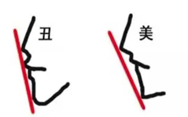 鼻部手术整形成都哪家医院好