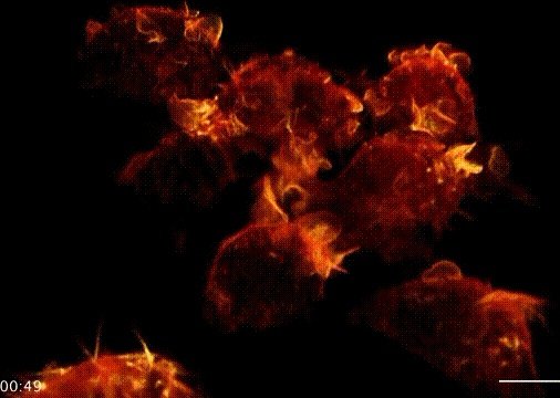 意大利3月19日单日新增病例4207例,为什么中国专家去了感觉没多少好转?