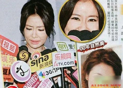 绝色美女整容过度 明星也难逃老残雷人宿命
