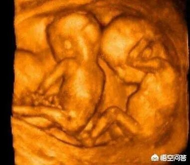 怀了双胞胎，他们会在妈妈肚子里打架吗？
