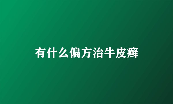 有什么偏方治牛皮癣