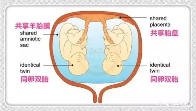 怀了双胞胎，他们会在妈妈肚子里打架吗？