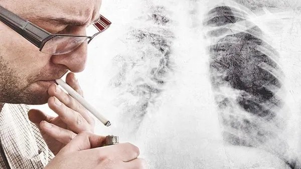 怎么可以戒烟方法快？7个戒烟的最好方法