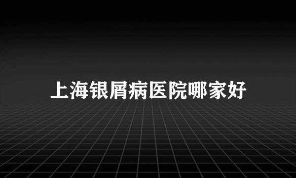 上海银屑病医院哪家好
