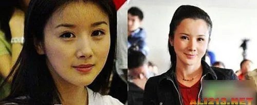 绝色美女整容过度 明星也难逃老残雷人宿命
