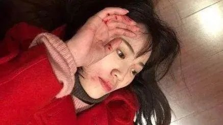马蓉疑似“摆拍”王宝强家暴图,分手后做到体面很难吗?