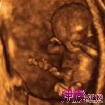 欣赏怀孕四个多月胎儿图片