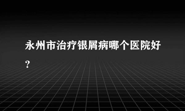 永州市治疗银屑病哪个医院好？
