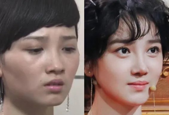陈小纭前后对比，整骨前后对比图