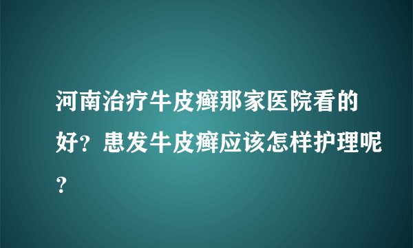 河南治疗牛皮癣那家医院看的好?患发牛皮癣应该怎样护理呢?