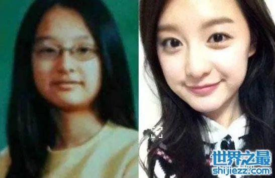 金智媛整容前后照片对比，皮肤黝黑四眼仔巨大眼袋 