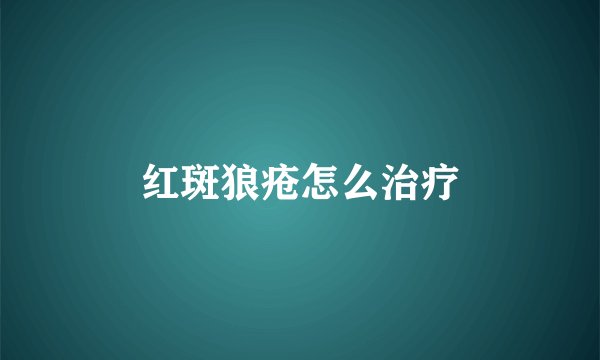 红斑狼疮怎么治疗