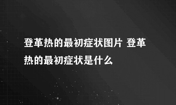登革热的最初症状图片 登革热的最初症状是什么