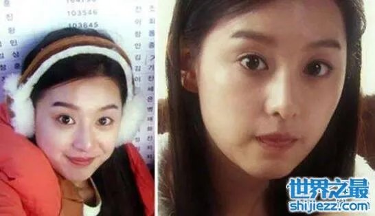 金智媛整容前后照片对比，皮肤黝黑四眼仔巨大眼袋 