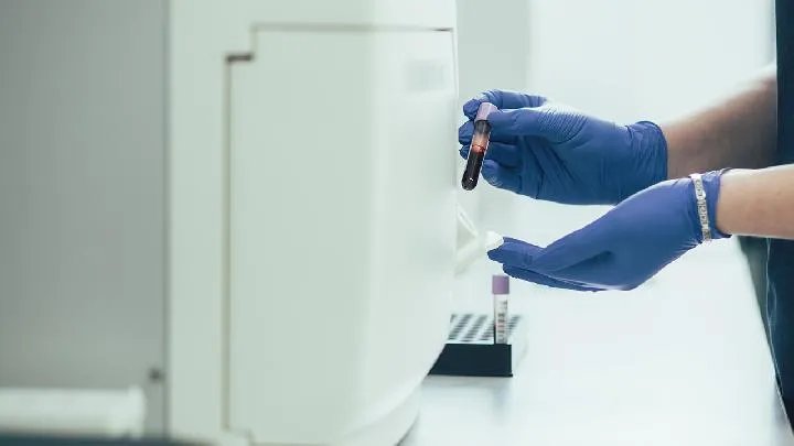 怎样区分普通感冒和新冠肺炎?区分普通感冒和新冠肺炎的办法是什么