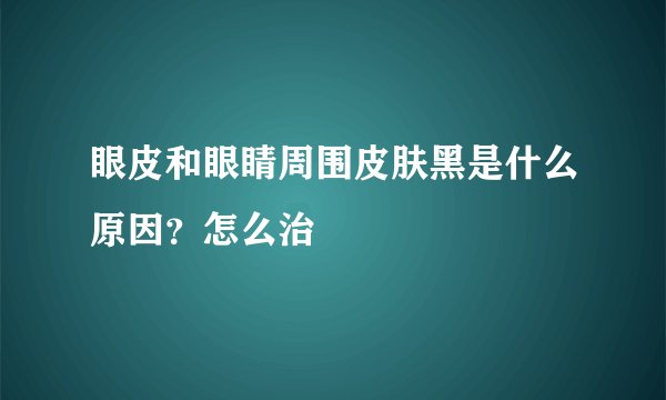 眼皮和眼睛周围皮肤黑是什么原因？怎么治