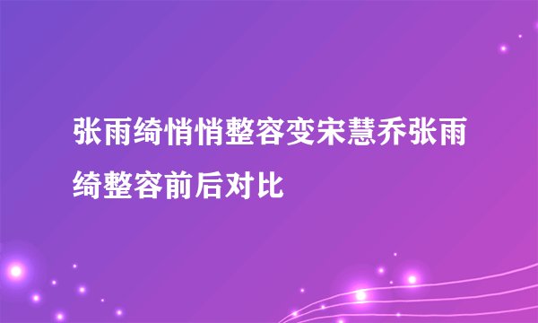 张雨绮悄悄整容变宋慧乔张雨绮整容前后对比